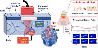 Acoustoelectric brain imaging with different conductivities and acoustic distributions